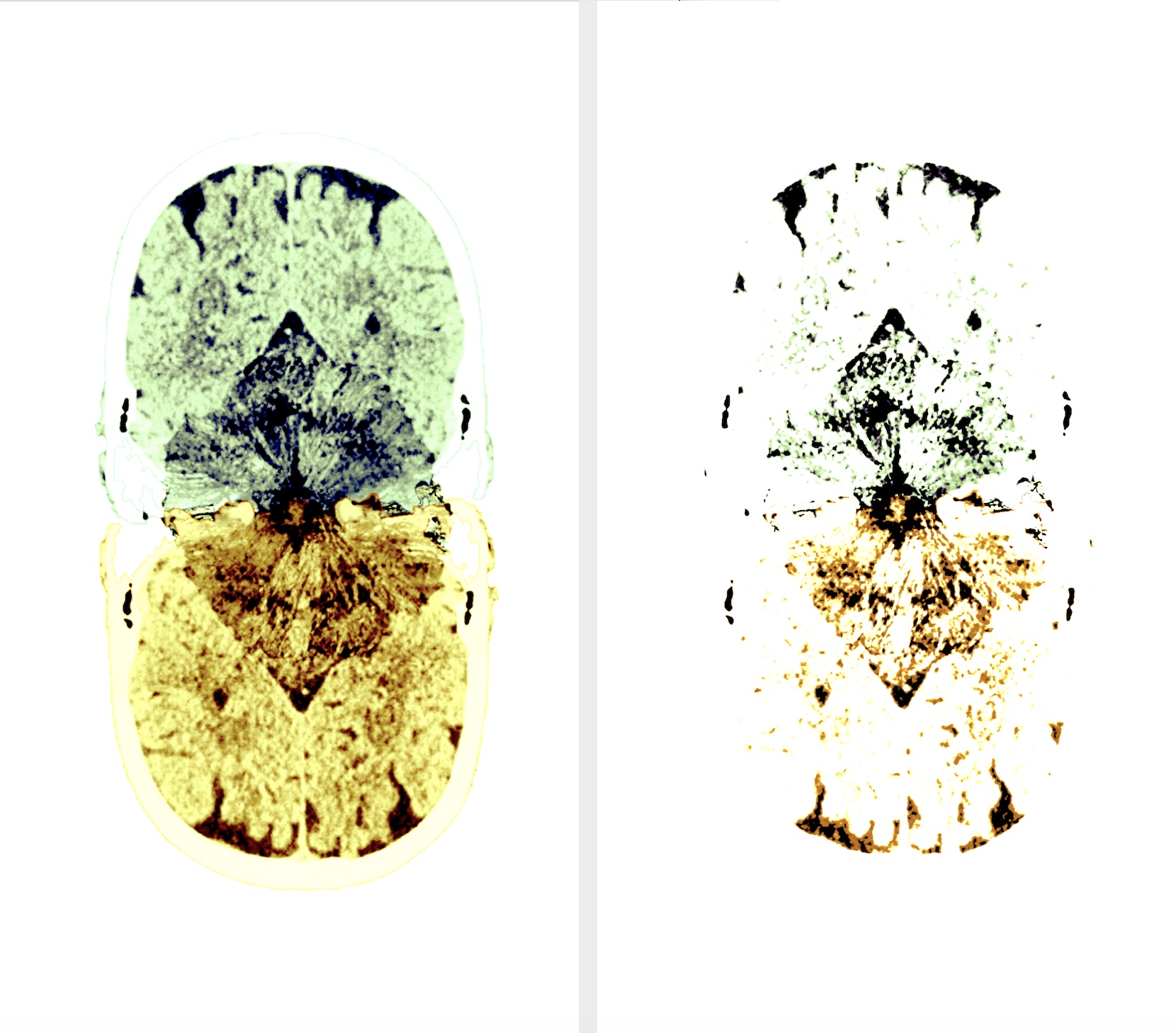 Two Brains Series
